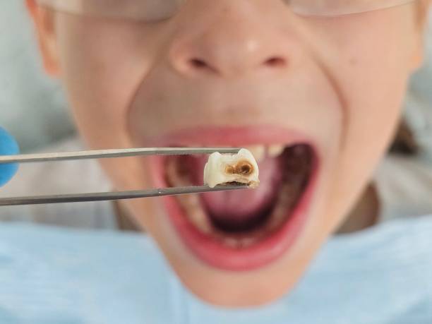 Best Emergency Treatment for Oral Infections in Campbell, FL